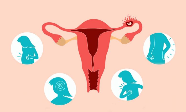 حاملگی خارج از رحمی