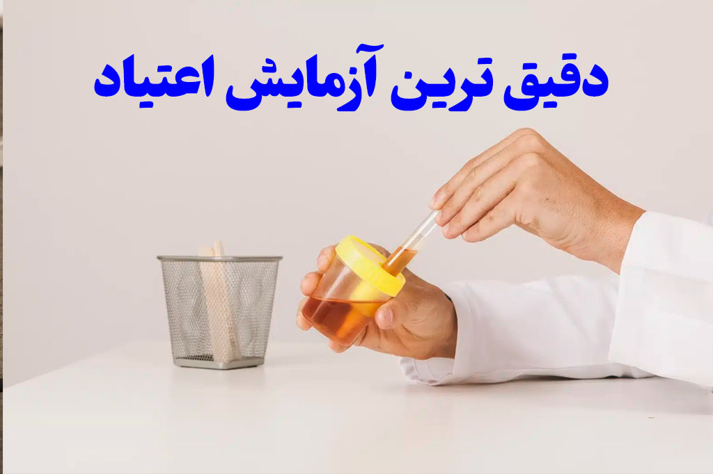 دقیق ترین ازمایش اعتیاد