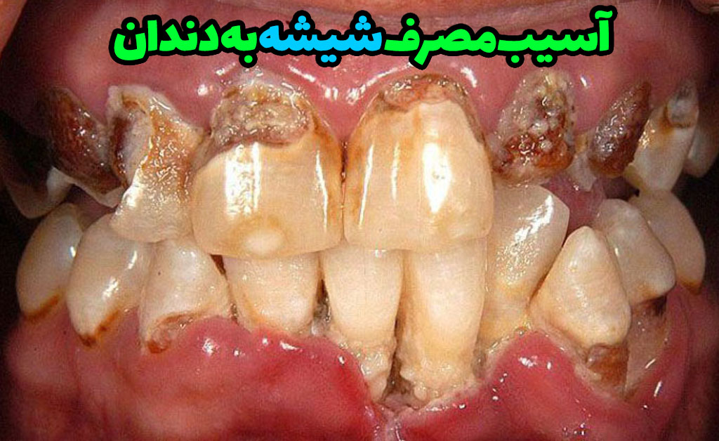 علائم فرد معتاد به شیشه