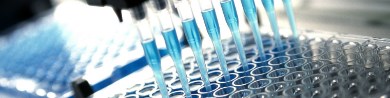 تست ایدز الیزا