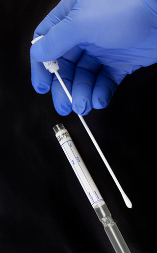 طول درمان سوزاک