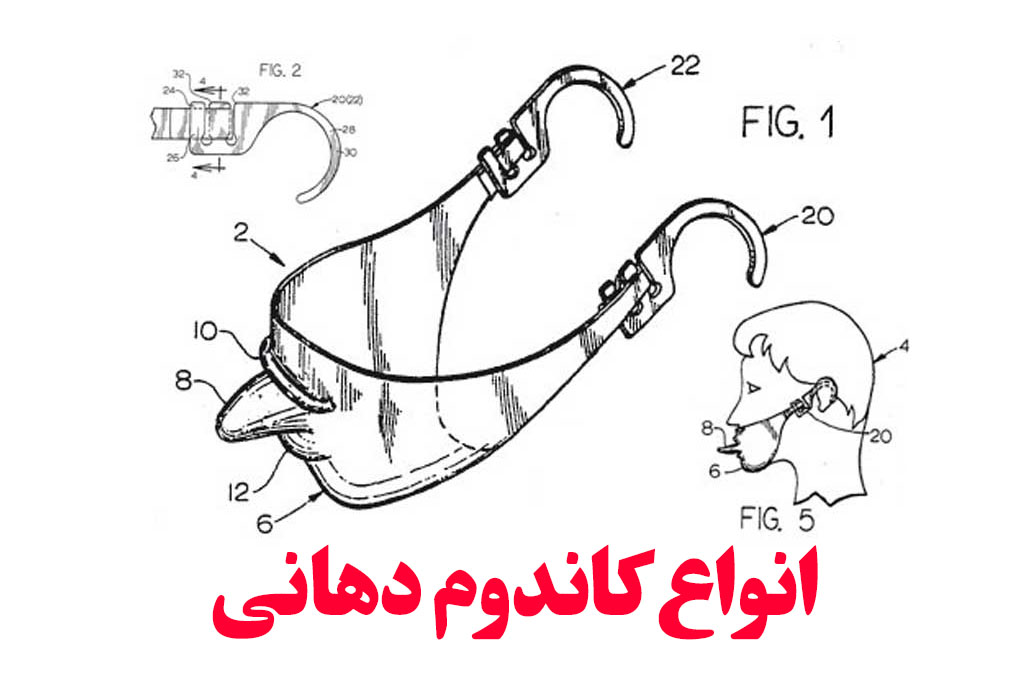 انواع کاندوم زبانی