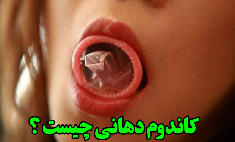 کاندوم دهانی