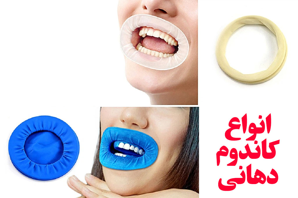 کاندوم زبانی