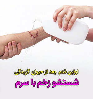 پیشگیری از هاری