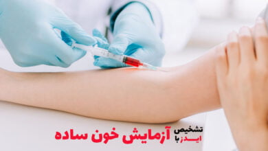 تشخیص ایدز با آزمایش خون ساده