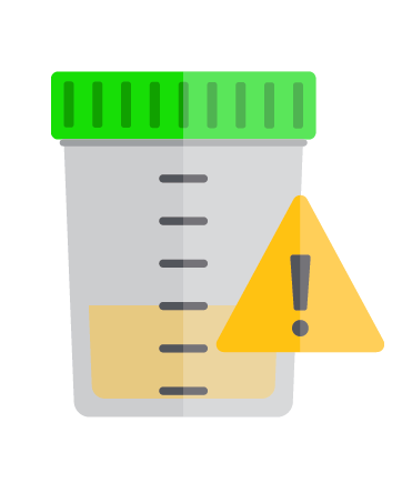 تست اعتیاد ادرار چیست؟