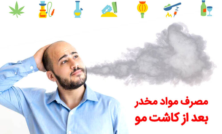 مصرف مواد مخدر بعد از کاشت مو