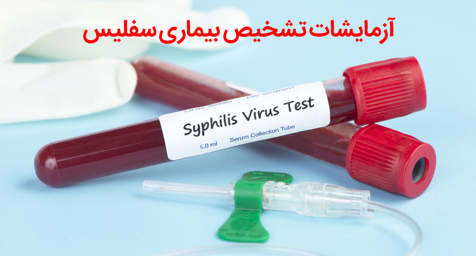 آزمایش تشخیص سفلیس