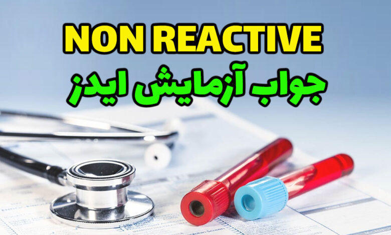 non-reactive در جواب آزمایش ایدز