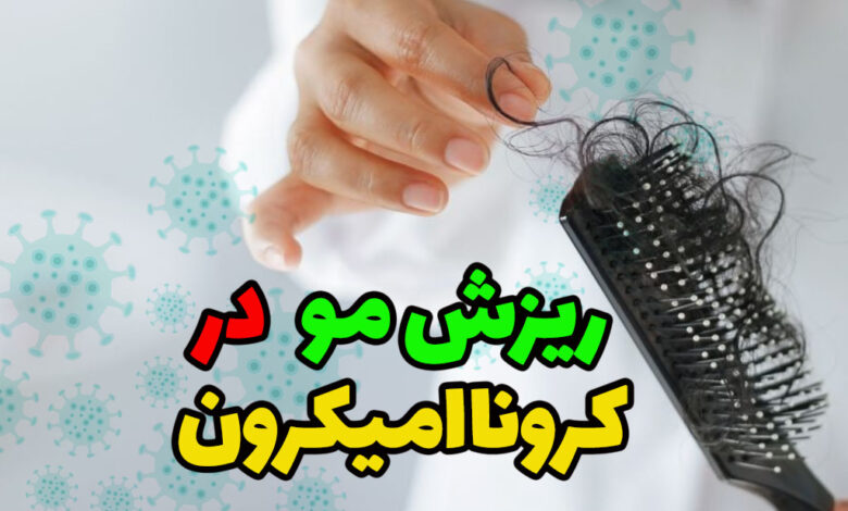 ریزش مو کرونا