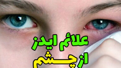 علائم ایدز از چشم