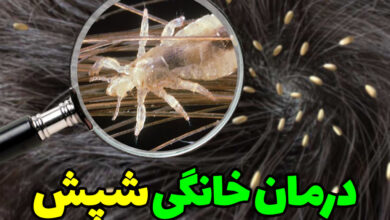 از بین بردن شپش در خانه
