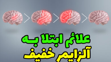 علائم آلزایمر خفیف