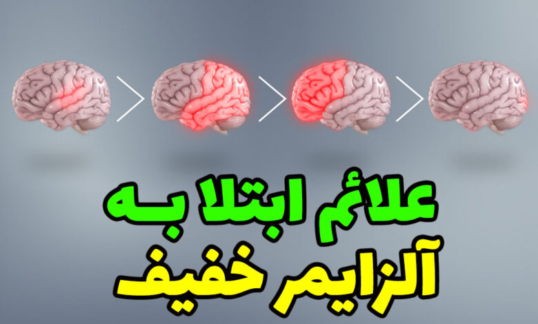 علائم آلزایمر خفیف