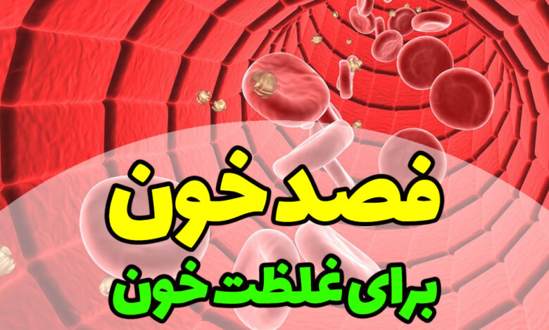 فصد خون برای غلظت خون