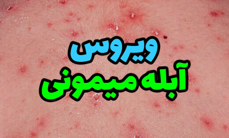 ویروس آبله میمون