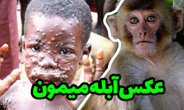 عکس آبله میمون