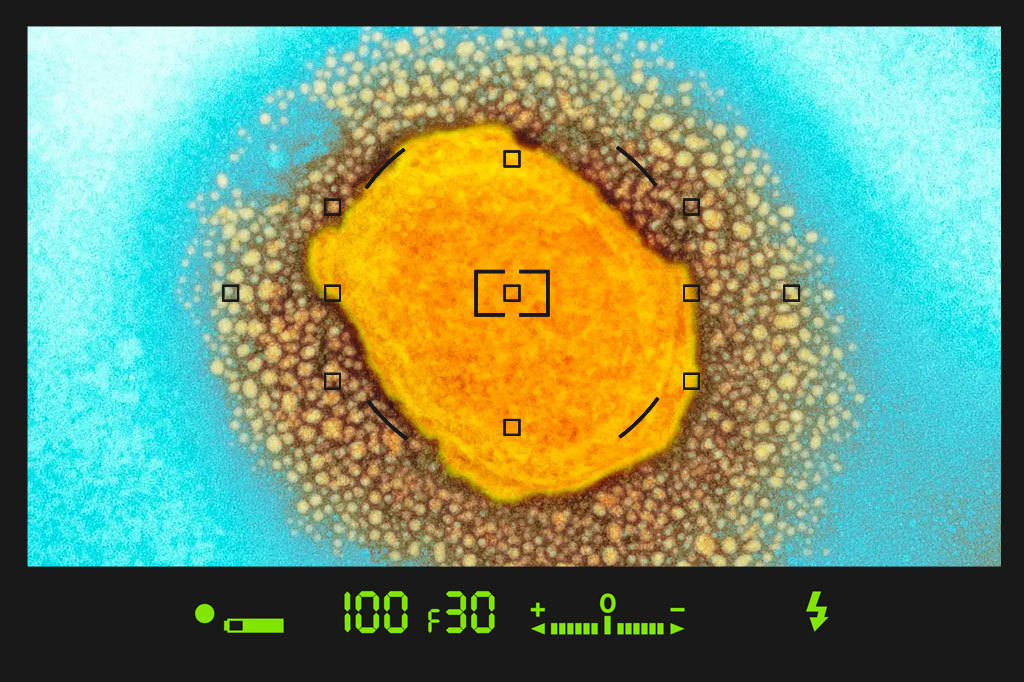 عکس ویروس آبله میمون