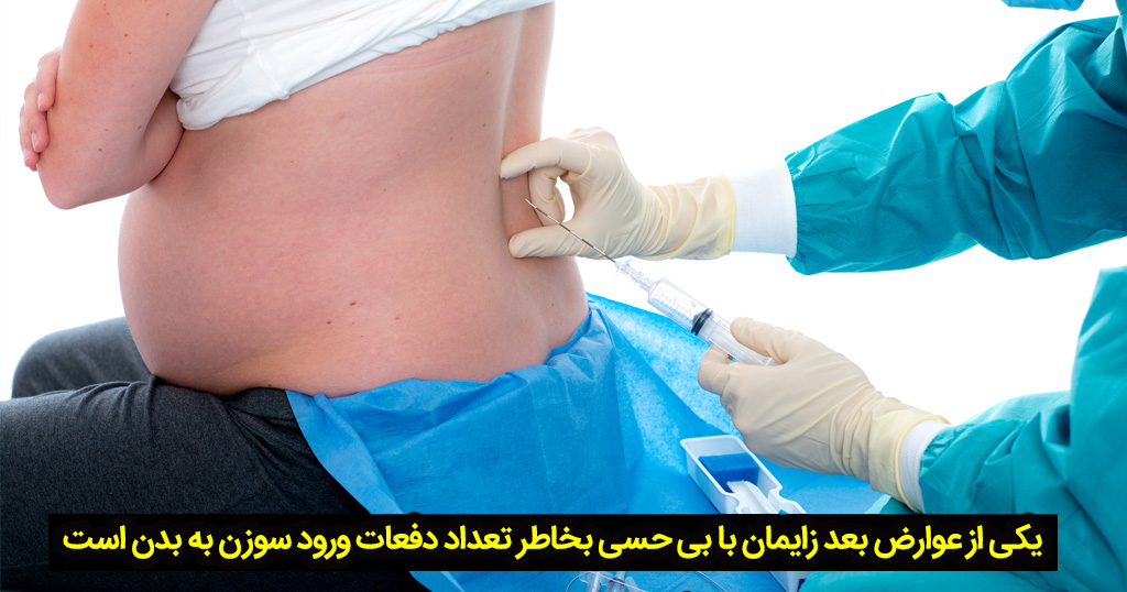 عوارض بعد از سزارین با بی حسی