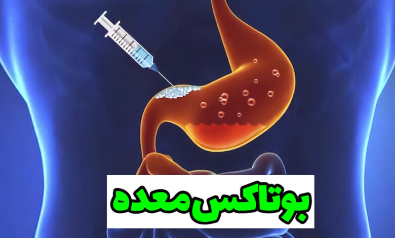 بوتاکس معده