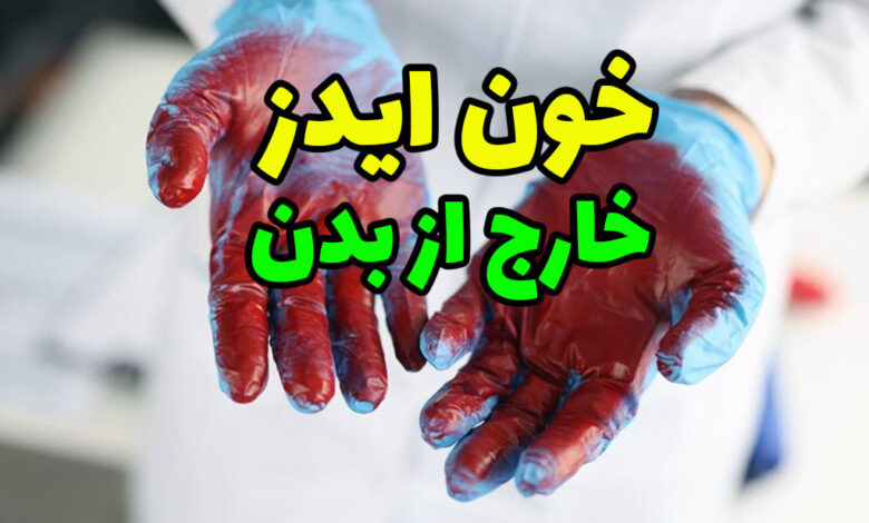 خون ایدز خارج از بدن
