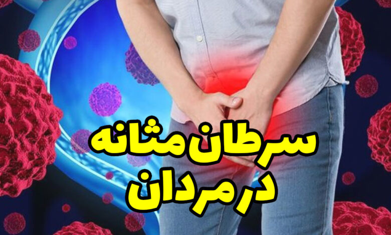 سرطان مثانه در مردان