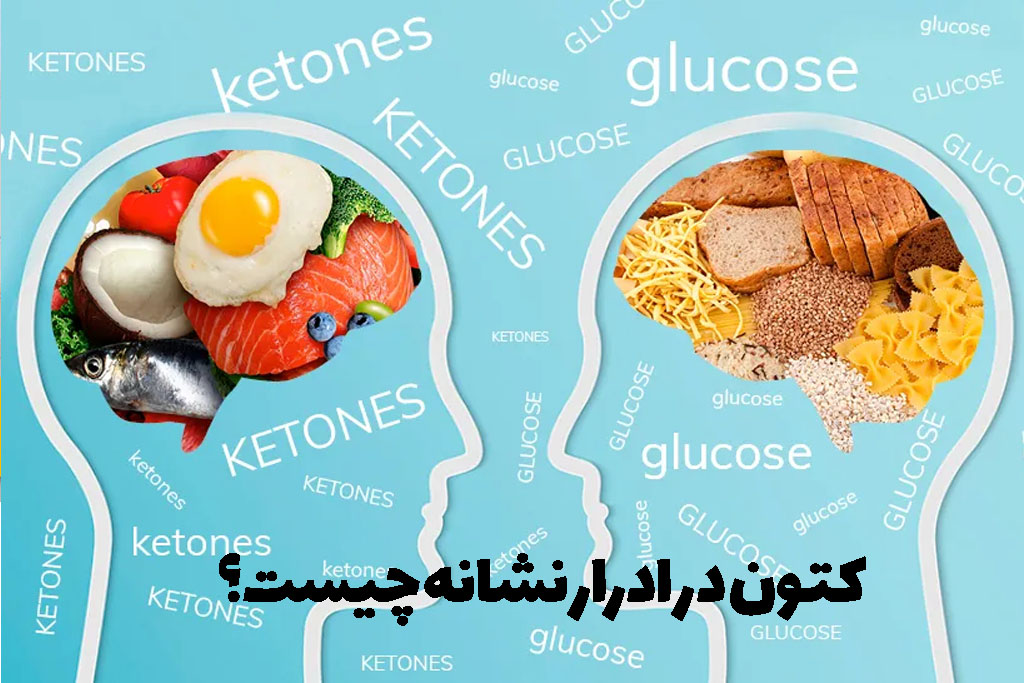 کتون در ادرار نشانه چیست