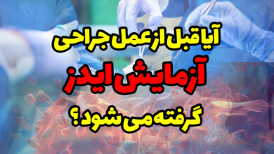 آیا قبل از عمل جراحی آزمایش ایدز گرفته میشود؟