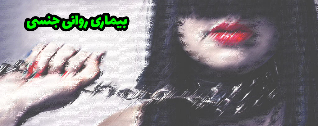 مازوخیسم جنسی یا خودآزاری یا آزار خواهی Sexual Masochism