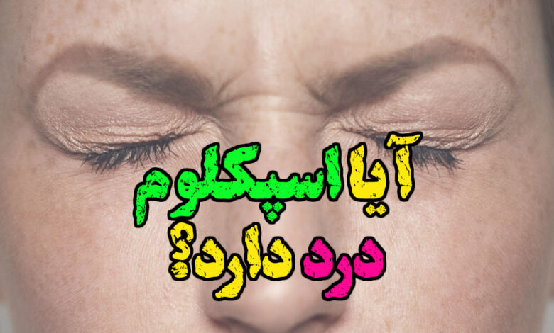 آیا اسپکلوم درد دارد؟