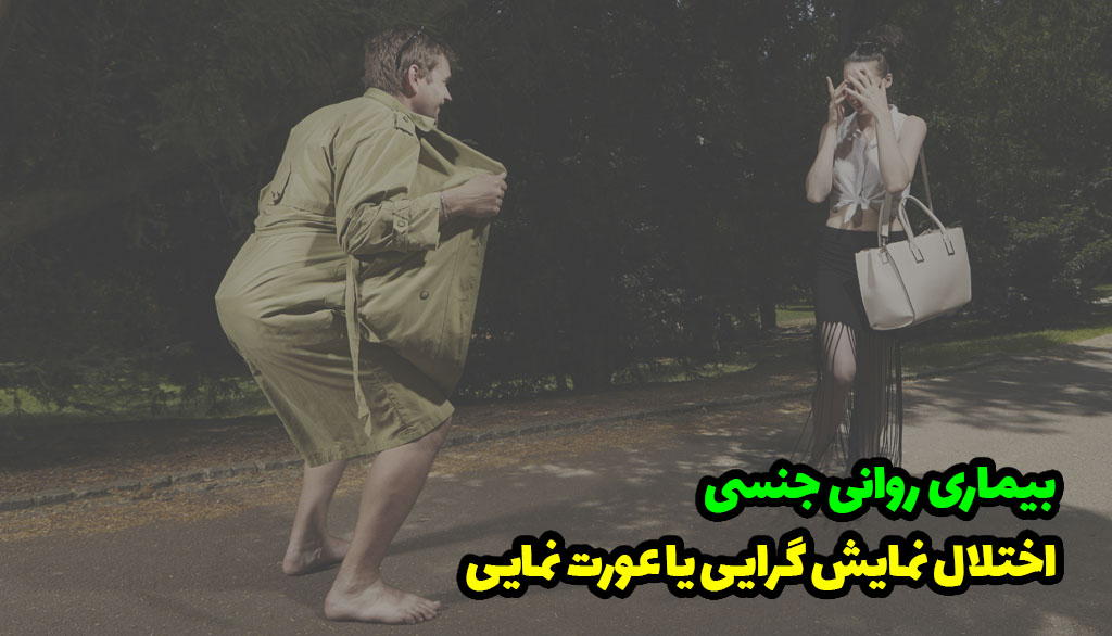 اختلال نمایش گرایی یا عورت نمایی یا Exhibitionism