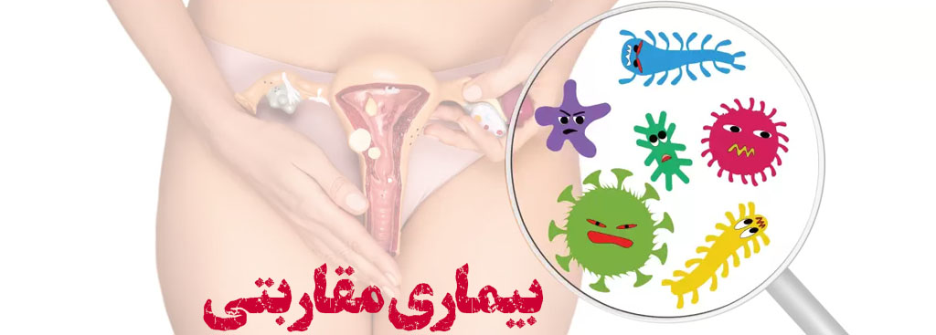 تبخال تناسلی