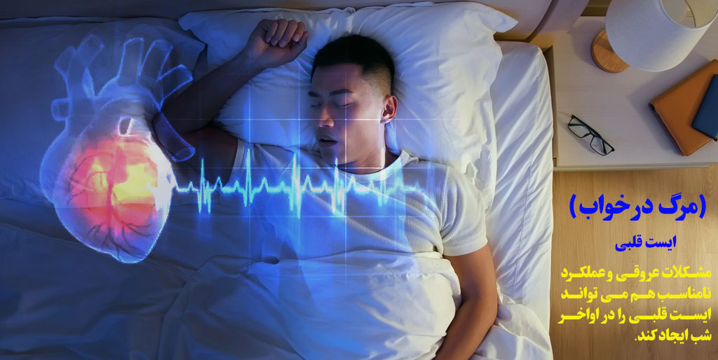 ایست قلبی مرگ در خواب