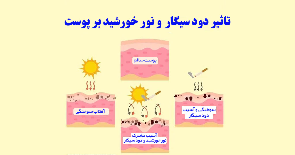 تاثییر نور خورشید و دود سیگار بر پوست