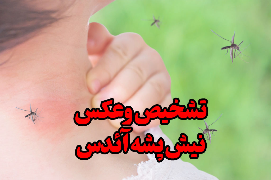 تشخیص و عکس نیش پشه آئدس