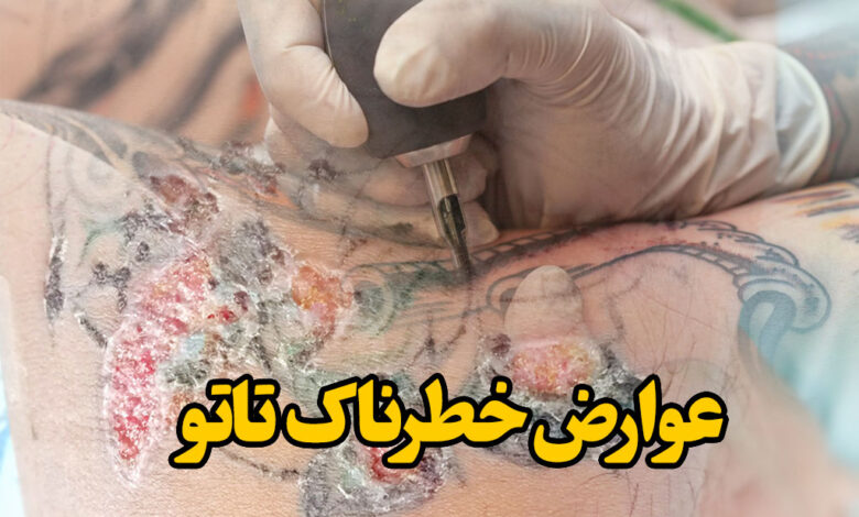 عوارض خطرناک تاتو