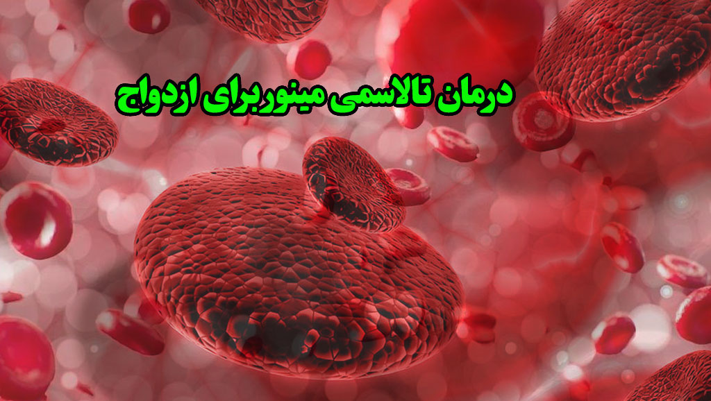 درمان تالاسمی مینور برای ازدواج