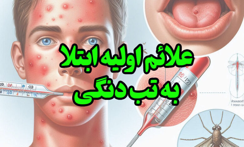 علائم ابتدایی اتلا به تب دنگی