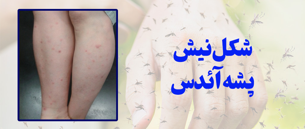 عکس جای نیش پشه دنگی