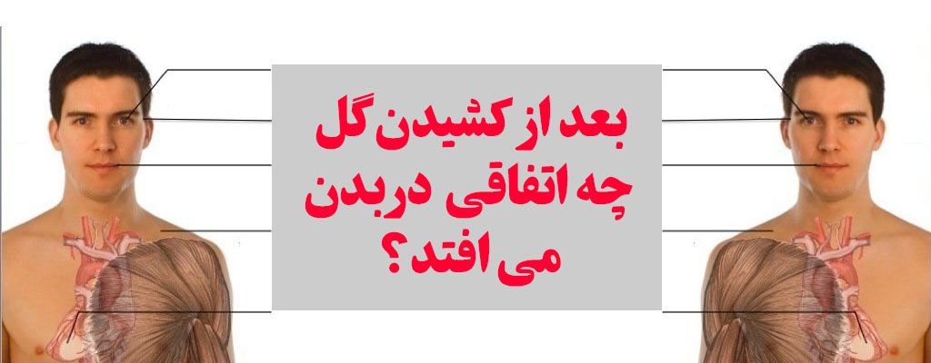 اتفاقات مصرف گل بر بدن