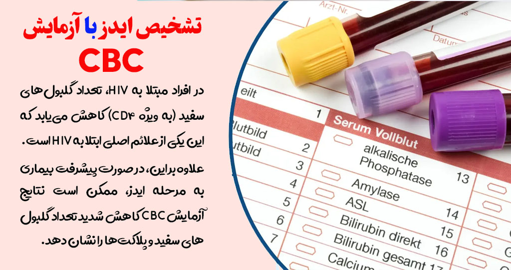 ایا در آزمایش cbc ایدز مشخص می شود