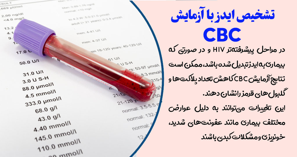 با آزمایش پلاکت ها cbc ایدز