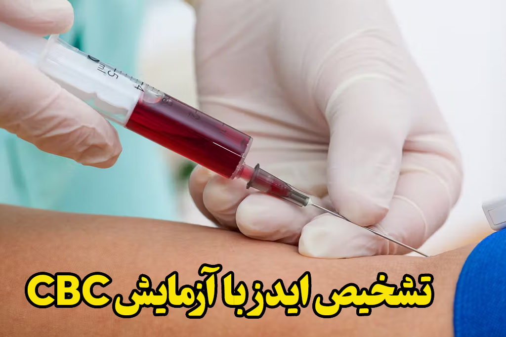 تست ایدز با آزمایش CBC