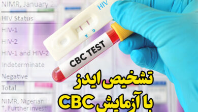 تشخیص ایدز با آزمایش CBC