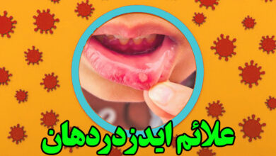 علائم ایدز در دهان