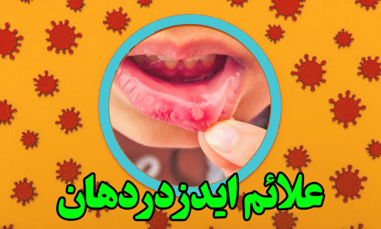 علائم ایدز در دهان