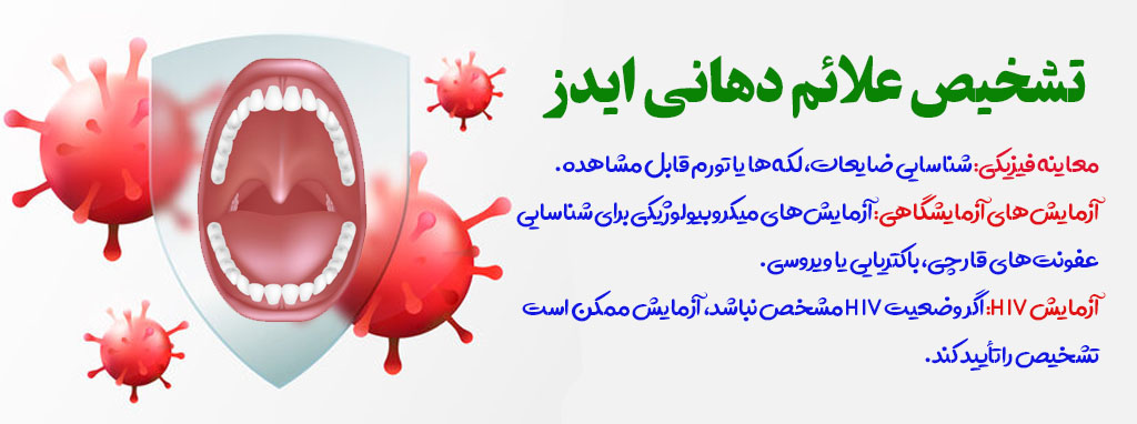 تشخیص نشانه دهانی ابتلا به ایدز