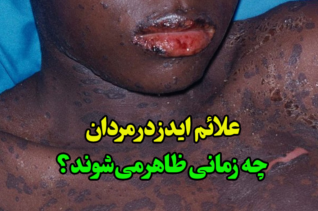 علائم اولیه hiv در مردان