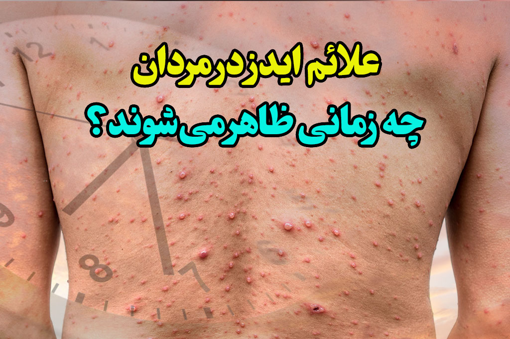 علائم اولیه ایدز در مردان